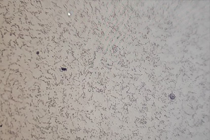 Deteksi fase emas-500 kali fase emas